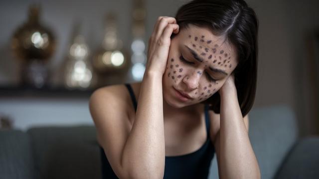 How to Clear Dark Spots on Face: Simple Tips for Clear Skin How to Clear Dark Spots on Face: Simple Tips for Clear Skin